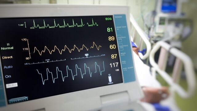 Sprzedaż nowoczesnych aparatów EKG - jakie modele warto wybrać?